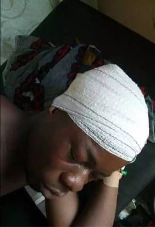 See How This Man Was Brutalized By A Drunk Policeman In Akwa Ibom State [Photos]